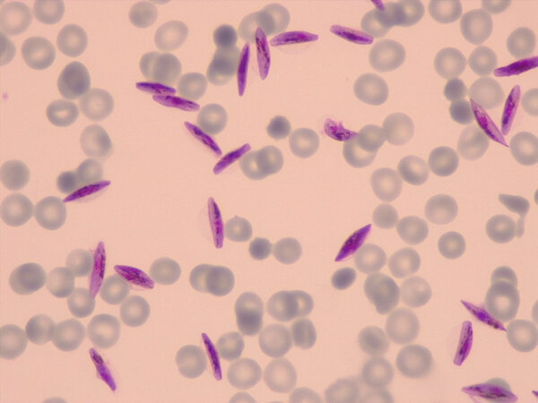 Neues Verständnis der Parasitenbiologie könnte dazu beitragen, die Malaria-Übertragung zu stoppen: