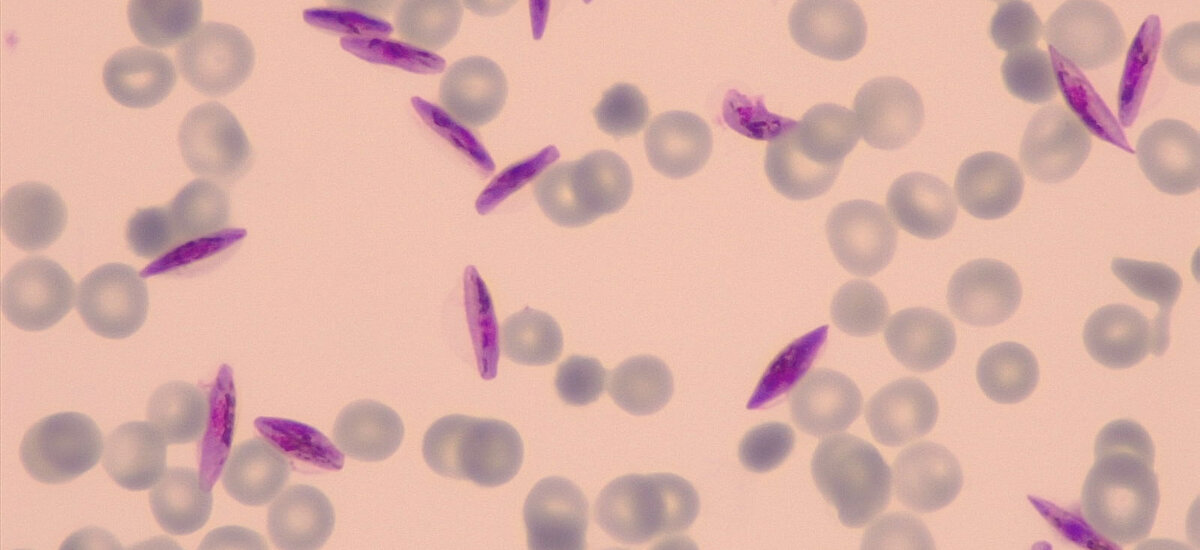 Neues Verständnis der Parasitenbiologie könnte dazu beitragen, die Malaria-Übertragung zu stoppen: