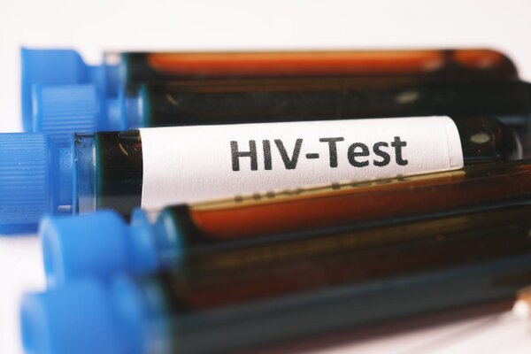 Zunahme von HIV- und STI-Infektionen in der Schweiz: Testzugang verbessern und schlüsselgruppen-spezifische Gesundheitsversorgung stärken!
