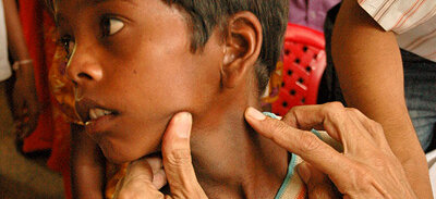 Leprosy: what are the final steps to elimination?