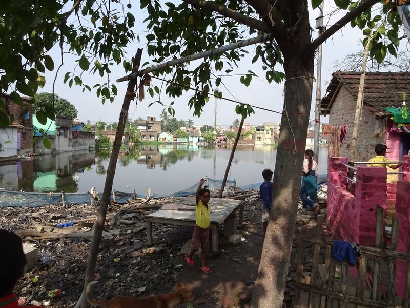 Undernutrition in an urban slum in India